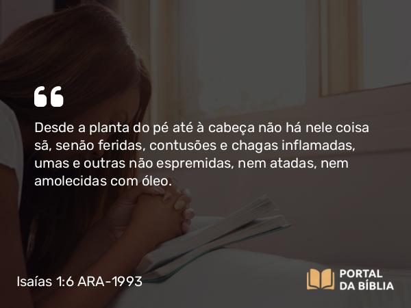 Isaías 1:6 ARA-1993 - Desde a planta do pé até à cabeça não há nele coisa sã, senão feridas, contusões e chagas inflamadas, umas e outras não espremidas, nem atadas, nem amolecidas com óleo.