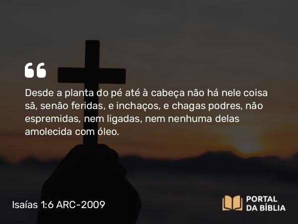 Isaías 1:6 ARC-2009 - Desde a planta do pé até à cabeça não há nele coisa sã, senão feridas, e inchaços, e chagas podres, não espremidas, nem ligadas, nem nenhuma delas amolecida com óleo.